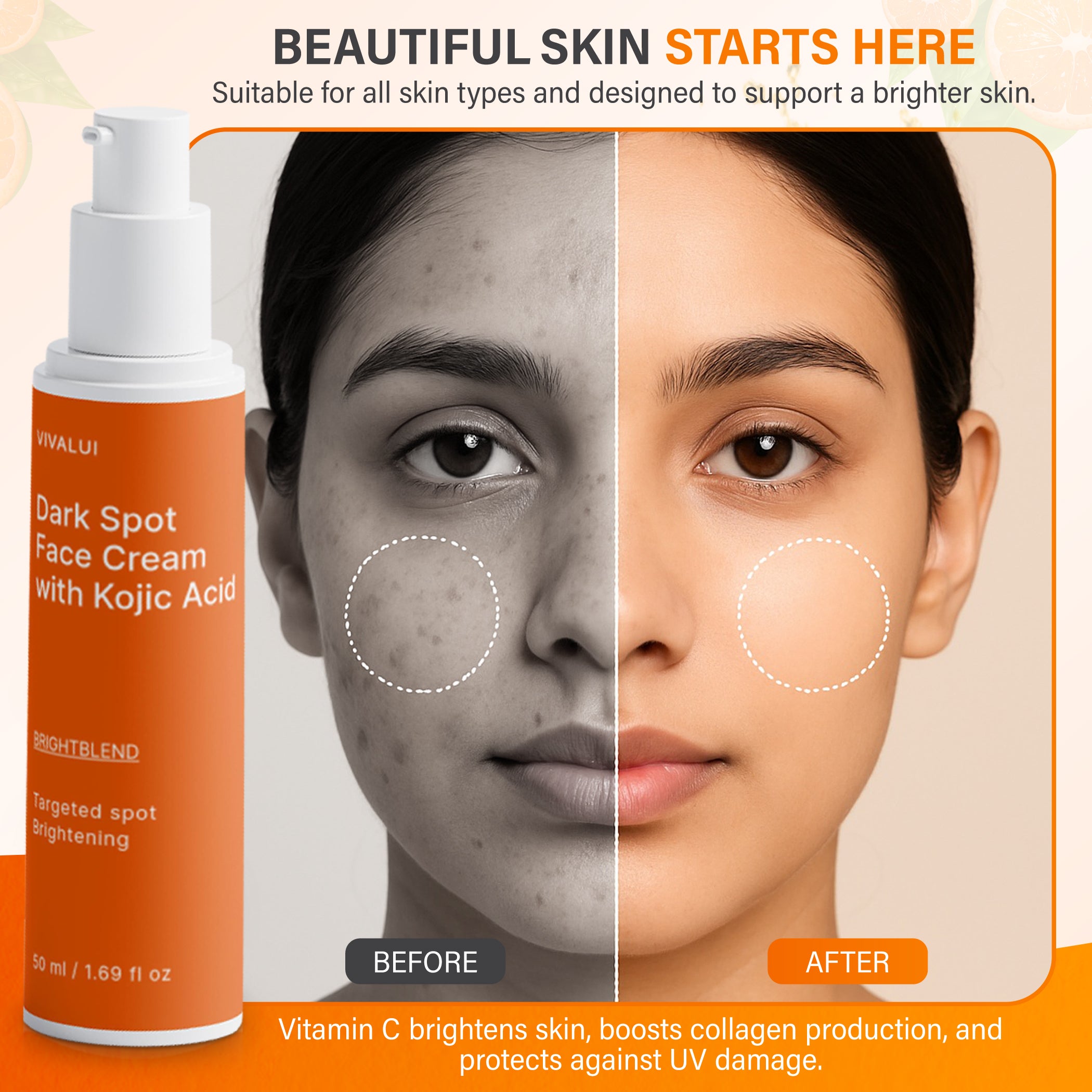 Dark Spot Face Cream with Kojic Acid